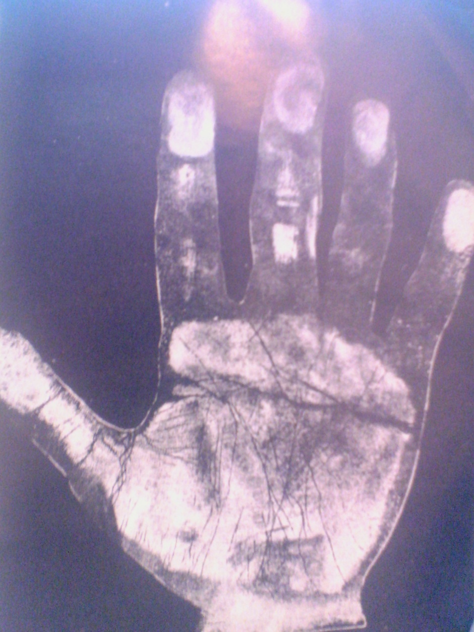 Hand Print of Dr. Meyer